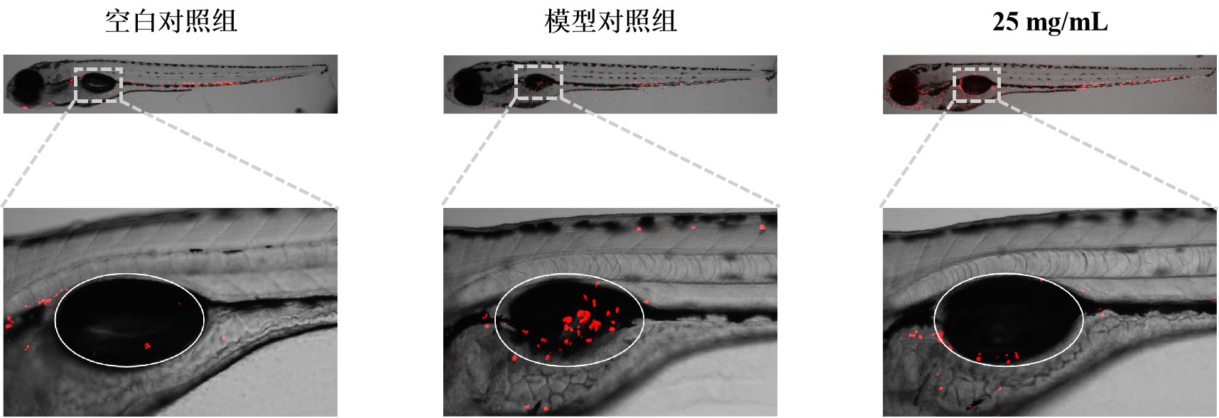 病毒性肺炎模型.jpg